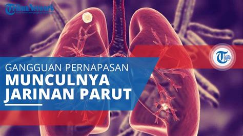 Fibrosis Paru Gangguan Pernapasan Yang Ditandai Dengan Munculnya