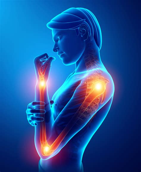 Do you have pain in the front rack position? — Arrow Physical Therapy