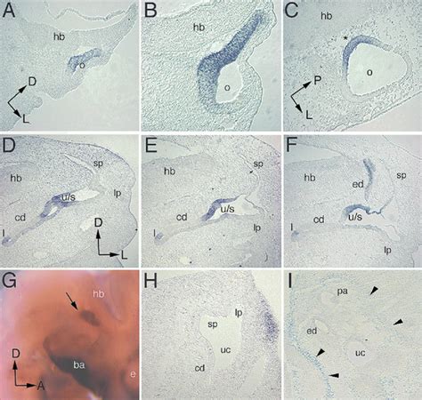 In Situ Hybridization Analysis Of Differential Screening Selected Gene