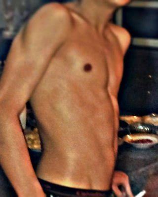 Viper Fisted By Tony Montana Porn Pictures XXX Photos Sex Images PICTOA