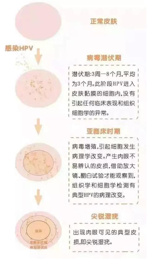 尖銳濕疣有哪些危害？ 每日頭條