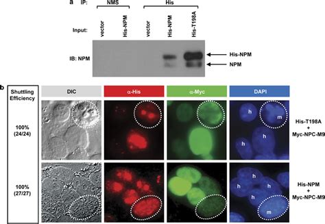 A Non Phosphorylatable T198A Nucleophosmin NPM Mutant Is Not A