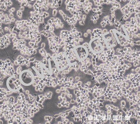 Raw 2647小鼠单核巨噬细胞白血病细胞 小鼠来源细胞 上海昆盟生物科技有限公司