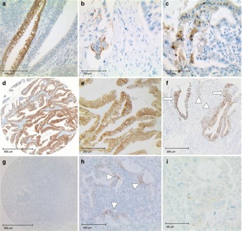 Photomicrographs Of TMA Examples Ac Artifacts Leading To Potential