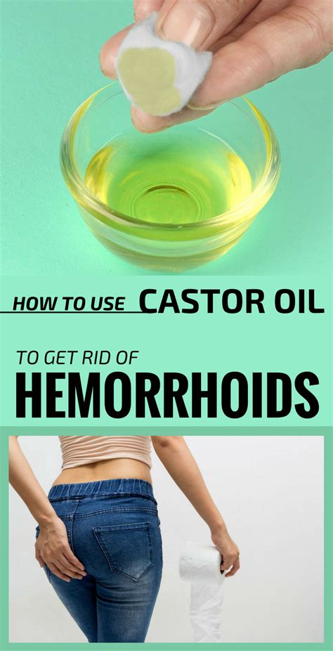 How To Use Castor Oil To Get Rid Of Hemorrhoids