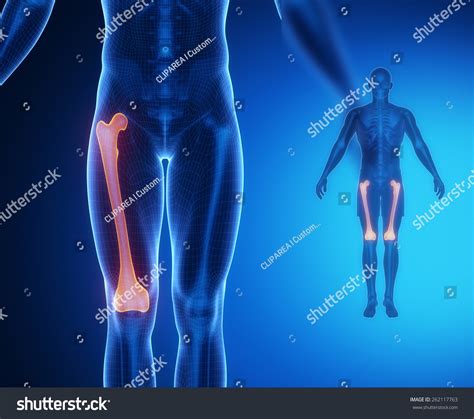 Femur X Ray Anatomy