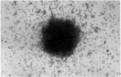 Representative Granulocyte Macrophage Colony Cfu Gm Derived From The Download Scientific