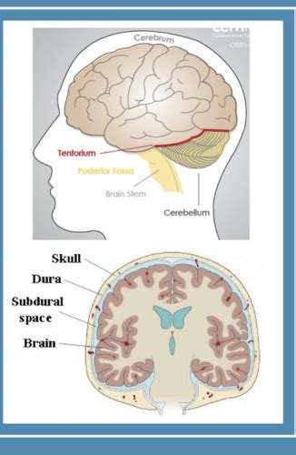 Patho Alterations In Cognitive Systems Exam Summer Flashcards