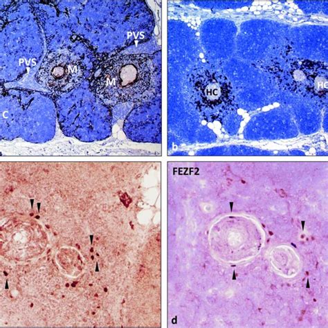 (PDF) Thymus and autoimmunity