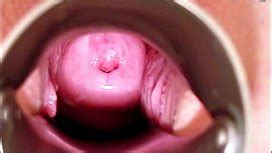 Gyno Pussy Speculum Exam Docto Closeups Vagina Cervix Humiliation Kinky Clinic B XNXX