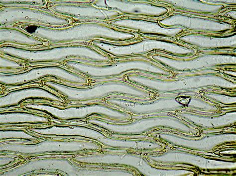 Camosun Blog : Sphagnum Under the Microscope