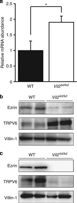 Real Time Reverse Transcription RT PCR And Immunoblotting Analysis