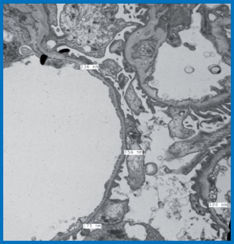 First Private Lab in India to Introduce Electron Microscopy - Dr Lal ... 