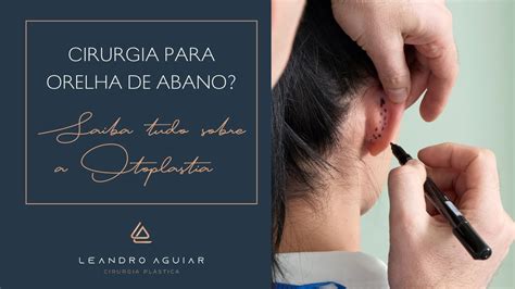 Cirurgia Para Orelha De Abano Saiba Tudo Sobre A Otoplastia Dr