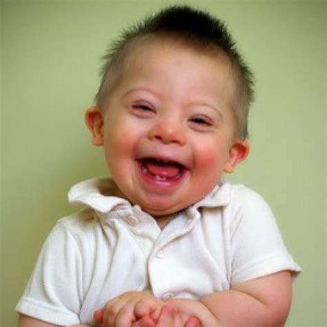 Photos Of Babies With Down Syndrome at Emery Espinosa blog