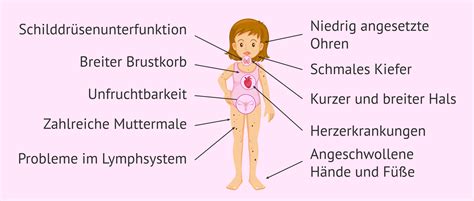 Turner Syndrom Ursachen Merkmale Und Schwangerschaft