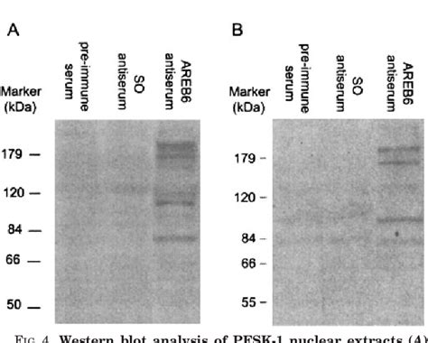 Figure 4 From Characterization Of Proteins Binding To E Box Ku86 Sites And Function Of Ku86 In