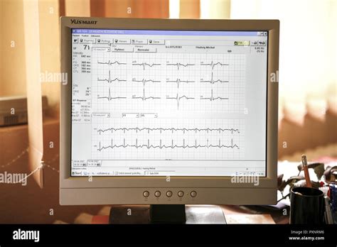 Ecg Snapshot Hi Res Stock Photography And Images Alamy