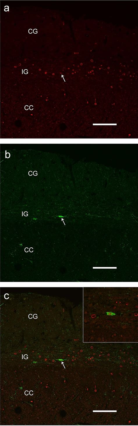 Confocal Laser Scanning Photomicrographs A NeuN Positive Cell A White