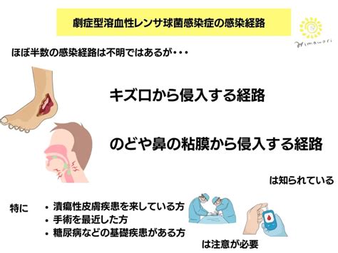 劇症型溶血性レンサ球菌感染症、近年に見ないほど増加していることが、国立感染症研究所から発表され、注目 毎日の勉強記録