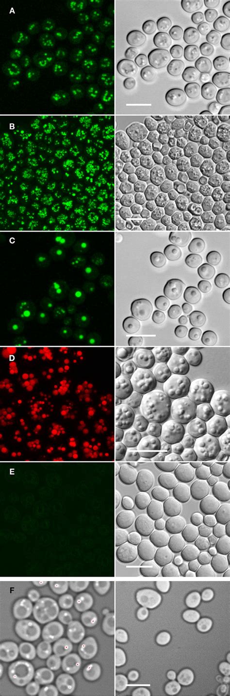 Analyzing LD Morphology As An Indicator Of TAG Homeostasis Using