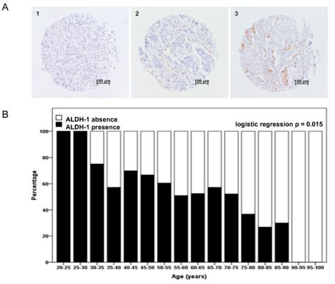 Aldh1 Expression And Distribution Over Age Groups A Representative