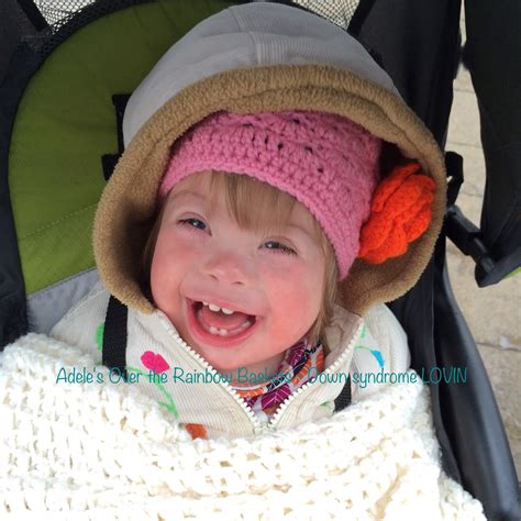 A Perfect Extra Chromosome: A Mild Case Of Down Syndrome