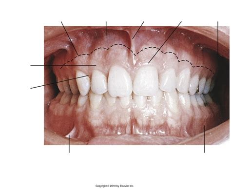 Da211 Gingiva And Anatomical Landmarks Diagram Quizlet