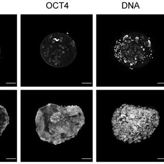 Lineage Development In Human Embryos Expression Of OCT4 And GATA4 In