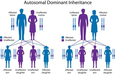 Waardenburg syndrome causes, types, symptoms, diagnosis & treatment