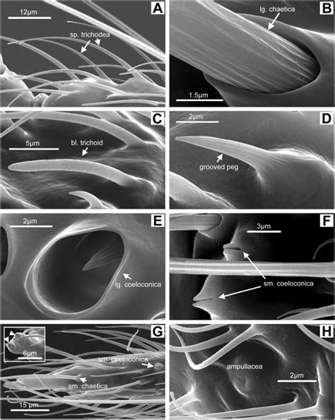 Sensilla Types Representative Scanning Electron Micrographs Showing