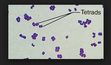 Peptostreptococcus Gram Stain