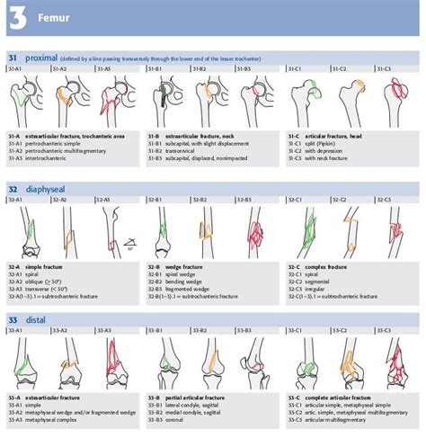 Ao Classification Femur Fracture