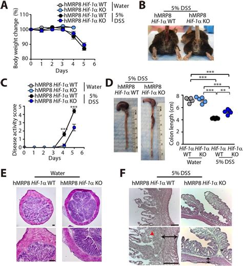 Hmrp8 Hif 1α Ko Mice Are Protected From Dss Induced Colitis Body Download Scientific Diagram