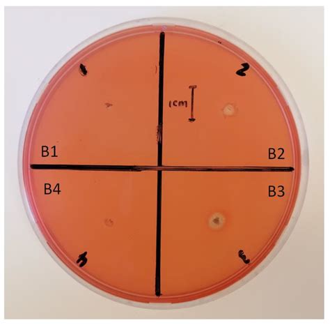 Pathogens Free Full Text Biocontrol Potential Of Bacillus Subtilis