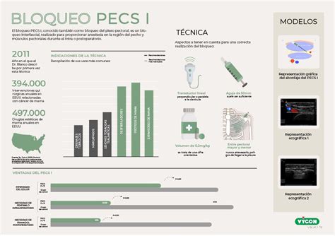 bloqueo fascial archivos Campus Vygon España