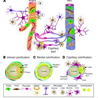 Schematic Representation Of Vascular Calcifications Along The Central