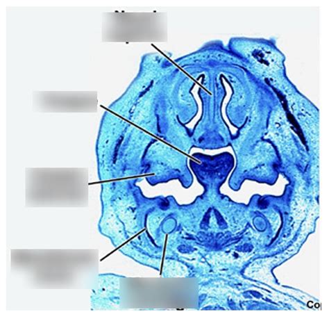 Diagram Of Coronal Section Of Developing Embryo Quizlet