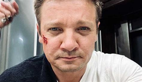 Após acidente Jeremy Renner o Gavião Arqueiro publica primeira foto