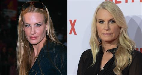 Daryl Hannah Plastic Surgery Disasters Purple Clover