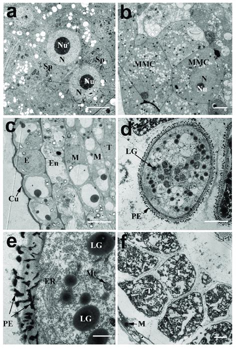 Transmission Electron Micrographs Of Cross Sections Through Anthers Of