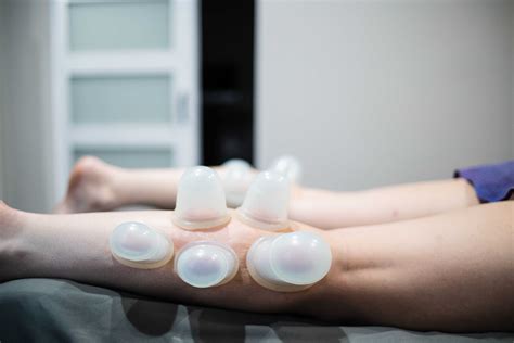 Reduce Inflammation & Improve Blood Flow with Cupping Therapy | Sports