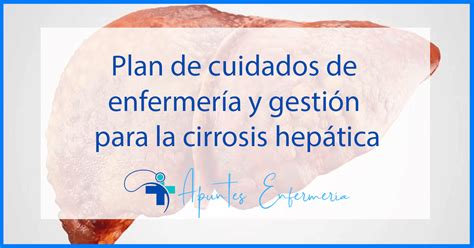 Plan de cuidados de enfermería y gestión de la cirrosis hepática 2024