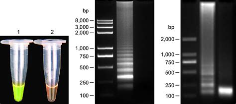 Visual Examination Agarose Gel Electrophoresis And Restriction Enzyme Download Scientific