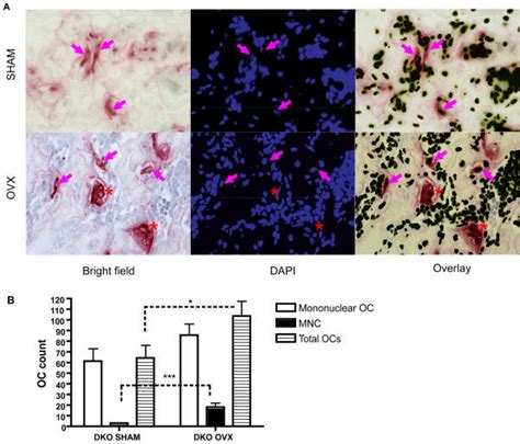 A Tracp Staining And Dapi Staining Was Performed On Paraffin Section