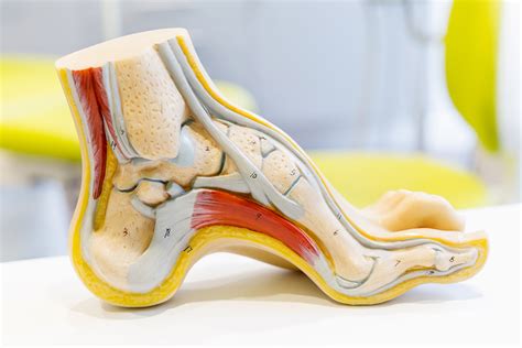 Treating Medial Plantar Nerve Entrapment - Thomas A. McDonald, MD, FAAOS