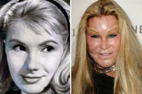 Jocelyn Wildensteins Transformation Photos Of The Stunning Beauty