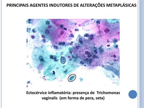 Aula De Citologia Onc Tica Sobre Citologia Inflamat Ria Ppt