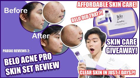 Belo Acne Pro Skin Set Honest Review Birthday Vlog Pabski