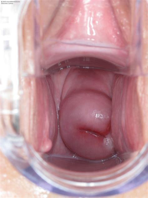 Erotic Porn In The Crack XXX Dessert Picture 16